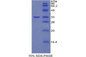 SDS-PAGE analysis of Rat AhR Protein. (Aryl Hydrocarbon Receptor Protein (AHR))