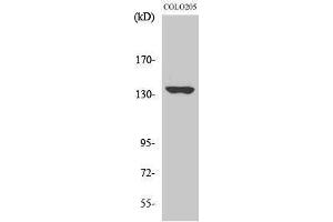 Western Blotting (WB) image for anti-MN1 proto-oncogene (MN1) (Internal Region) antibody (ABIN3185603) (Meningioma 1 Antikörper  (Internal Region))