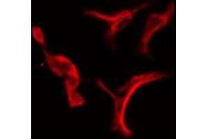 ABIN6274716 staining Hela cells by IF/ICC. (PSMD3 Antikörper  (C-Term))