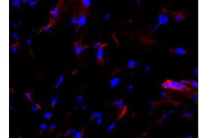 Frozen equine sacroid tissue section was stained with anti-MHC I followed by Goat Anti-Mouse IgG2a, Human ads-TRITC (Ziege anti-Maus IgG2a (Heavy Chain) Antikörper (TRITC))