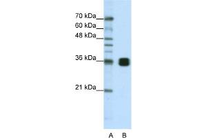 Western Blotting (WB) image for anti-Heterogeneous Nuclear Ribonucleoprotein A0 (HNRNPA0) (Middle Region) antibody (ABIN2779011)