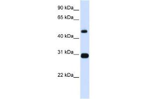 WB Suggested Anti-PSMC3 Antibody Titration: 0. (PSMC3 Antikörper  (N-Term))