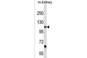 Western Blotting (WB) image for anti-Prostaglandin F2 Receptor Negative Regulator (PTGFRN) (AA 458-485) antibody (ABIN1538438)