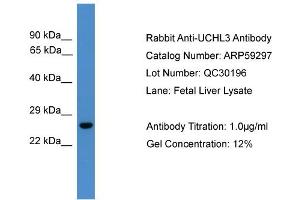 WB Suggested Anti-UCHL3  Antibody Titration: 0. (UCHL3 Antikörper  (C-Term))