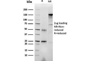 SDS-PAGE Analysis Purified RET Mouse Monoclonal Antibody (RET/2976).