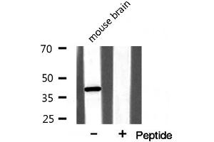 Western blot analysis on mouse brain lysate using NPM Antibody (NPM1 Antikörper  (N-Term))