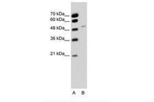 Image no. 1 for anti-RNA Binding Motif Protein 22 (RBM22) (AA 301-350) antibody (ABIN6736326) (RBM22 Antikörper  (AA 301-350))