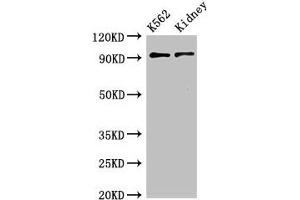 Western Blot Positive WB detected in:K562 whole cell lysate,Mouse kidney tissue All lanes:AP1G1 antibody at 3.
