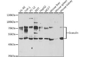Western blot analysis of extracts of various cell lines, using Granulin antibody (ABIN6131043, ABIN6141430, ABIN6141432 and ABIN6221454) at 1:1000 dilution. (Granulin Antikörper  (AA 20-310))