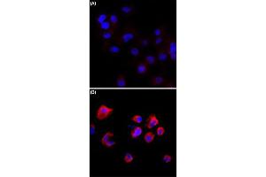 Immunocytochemistry staining of serum-starved A431 cells (A) and serum-starved A431 cells treated with Calyculin A/Okadaic Acid (B) using Phosphothreonine monoclonal antibody, clone RM102  (Red) at 1:500 dilution. (Phosphothreonine Antikörper)