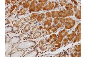 Immunoperoxidase of monoclonal antibody to LIMK1 on formalin-fixed paraffin-embedded human stomach. (LIM Domain Kinase 1 Antikörper  (AA 548-647))