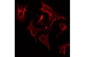 ABIN6275202 staining COLO205 cells by IF/ICC.