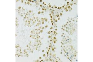 Immunohistochemistry (Paraffin-embedded Sections) (IHC (p)) image for anti-Adenosine Deaminase, RNA-Specific (ADAR) (AA 150-250) antibody (ABIN6136553)