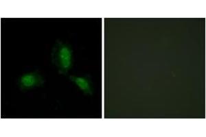 Immunofluorescence analysis of HeLa cells, using IRS-1 (Ab-312) Antibody.