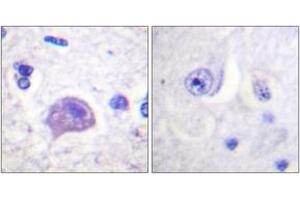 Immunohistochemistry analysis of paraffin-embedded human brain tissue, using HRS (Ab-334) Antibody. (HRS (HRS) (AA 301-350) Antikörper)