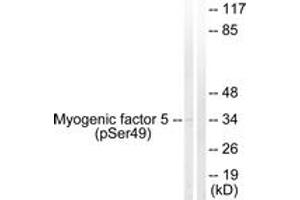 Western blot analysis of extracts from HeLa cells, using Myogenic Factor 5 (Phospho-Ser49) Antibody. (MYF5 Antikörper  (pSer49))