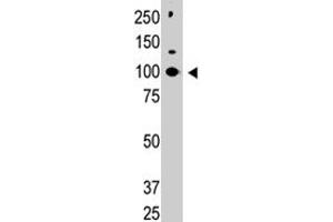 Western blot analysis of CBLC polyclonal antibody  in HL-60 cell lysate. (CBLC Antikörper  (C-Term))