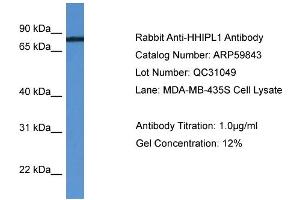 WB Suggested Anti-HHIPL1  Antibody Titration: 0. (HHIPL1 Antikörper  (C-Term))