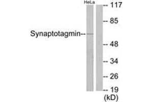 Western Blotting (WB) image for anti-Synaptotagmin (SYT) (AA 176-225) antibody (ABIN2888581) (Synaptotagmin Antikörper  (AA 176-225))