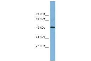WB Suggested Anti-UEVLD  Antibody Titration: 0. (UEVLD Antikörper  (Middle Region))