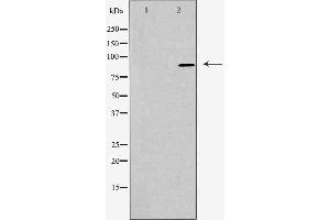 Western blot analysis of extracts from LOVO cells, using RHG9 antibody. (ARHGAP9 Antikörper  (Internal Region))