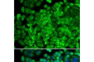 Immunofluorescence analysis of HeLa cells using GLA Polyclonal Antibody (GLA Antikörper)