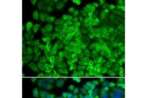 Immunofluorescence analysis of HeLa cells using GLA Polyclonal Antibody (GLA Antikörper)