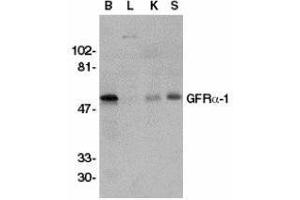 Western Blotting (WB) image for anti-GDNF Family Receptor alpha 1 (GFRA1) antibody (ABIN2473776) (GFRA1 Antikörper)