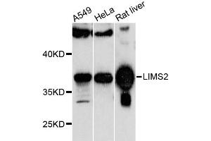 Western blot analysis of extracts of various cell lines, using LIMS2 antibody (ABIN6293255) at 1:1000 dilution.