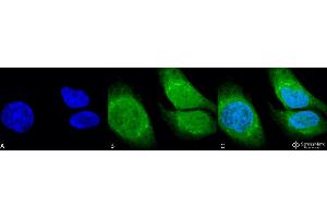 Immunocytochemistry/Immunofluorescence analysis using Rabbit Anti-GRP78 (Bip) Polyclonal Antibody . (GRP78 Antikörper  (N-Term) (PerCP))