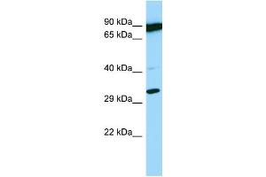 Host: Rabbit Target Name: PSMB11 Sample Type: OVCAR-3 Whole Cell lysates Antibody Dilution: 1. (PSMB11 Antikörper  (C-Term))