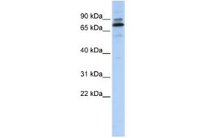 WB Suggested Anti-C14orf21 Antibody Titration:  0. (C14orf21 Antikörper  (Middle Region))