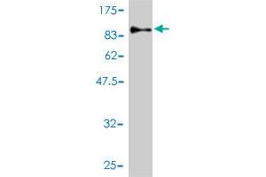 Western Blot detection against Immunogen (89. (CDKN2AIP Antikörper  (AA 1-579))