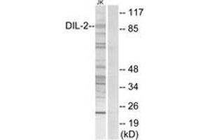 Western blot analysis of extracts from Jurkat cells, using DIL-2 Antibody. (TPX2 Antikörper  (AA 301-350))