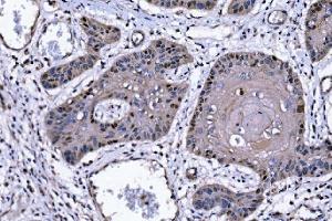 IHC analysis of p57 Kip2/CDKN1C using anti-p57 Kip2/CDKN1C antibody (ABIN7603232).