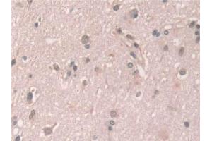 Detection of GCA in Human Cerebrum Tissue using Polyclonal Antibody to Grancalcin (GCA)