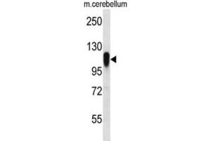 Western Blotting (WB) image for anti-F-Box Protein 41 (FBXO41) antibody (ABIN2996836) (FBXO41 Antikörper)