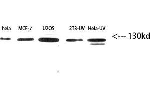 Western Blot (WB) analysis of HeLe,MCF7,U2OS,3T3-UV,HeLa-UV using Integrin β3 Polyclonal Antibody diluted at 1:2000 (Integrin beta 3 Antikörper  (Internal Region))