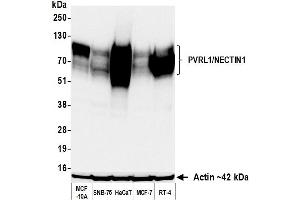 Western Blotting (WB) image for anti-Nectin-1 (NECTIN1) (AA 225-275) antibody (ABIN7795684) (Rekombinanter Nectin-1 (NECTIN1) (AA 225-275) Antikörper)