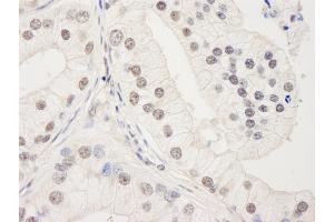 Immunohistochemistry (IHC) image for anti-Uveal Autoantigen With Coiled Coil Domains And Ankyrin Repeats (UACA) (AA 675-725) antibody (ABIN7454403)