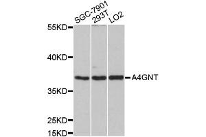 Western blot analysis of extracts of various cell lines, using A4GNT antibody (ABIN5997161) at 1/1000 dilution. (A4GNT Antikörper)