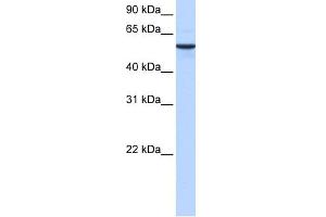 WB Suggested Anti-DPH2 Antibody Titration: 0. (DPH2 Antikörper  (N-Term))