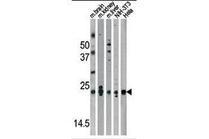 Western blot analysis of anti-Park7 (DJ-1) Antibody (N-term) in mouse brain,kidney,liver tissue lysates and NIH-3T3, Hela cell line lysates (35ug/lane). (PARK7/DJ1 Antikörper  (N-Term))