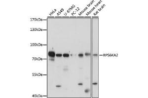 Western blot analysis of extracts of various cell lines, using RPS6K antibody (ABIN7270037) at 1:1000 dilution. (RPS6KA2 Antikörper  (AA 632-733))
