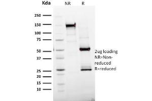 SDS-PAGE Analysis Purified Ki67 Mouse Monoclonal Antibody (MKI67/2465). (Ki-67 Antikörper  (AA 2293-2478))