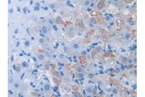 IHC-P analysis of Mouse Ovary Tissue, with DAB staining. (BDNF Antikörper  (AA 139-249))
