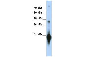 C17ORF49 antibody used at 1 ug/ml to detect target protein. (C17orf49 Antikörper  (Middle Region))