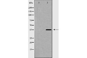Western blot analysis of hnRPD expression in 293 cell extract. (HNRNPD/AUF1 Antikörper  (Internal Region))