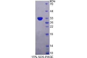 Image no. 1 for Mps1 (TTK) (AA 532-786) protein (His tag) (ABIN6238062)