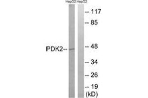Western blot analysis of extracts from HepG2 cells, using PDK2 Antibody. (PDK2 Antikörper  (AA 260-309))